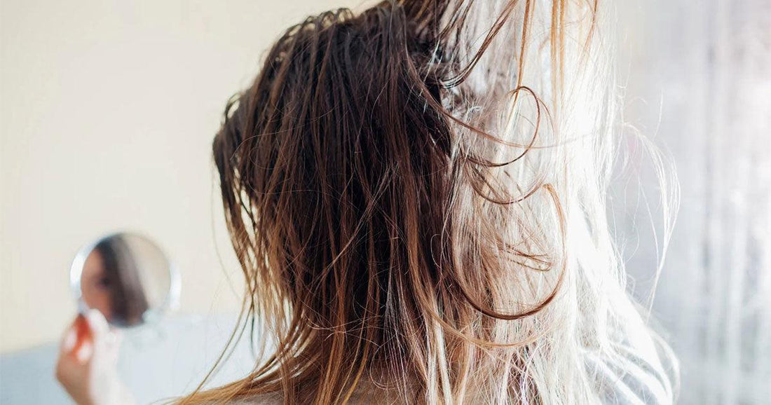 Quoi faire pour apaiser un cuir chevelu gras qui pique? - Clinique à Deux Cheveux