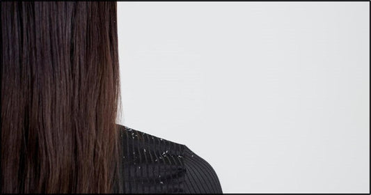Pellicules Sèches ou Psoriasis: Découvrir Les Différences Clés - Clinique à Deux Cheveux