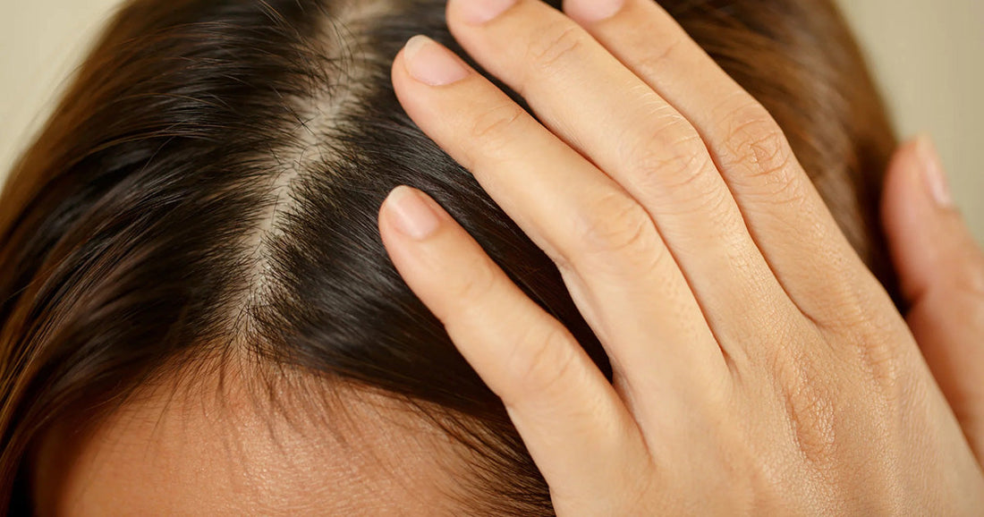 Femme avec perte de cheveux et démangeaisons