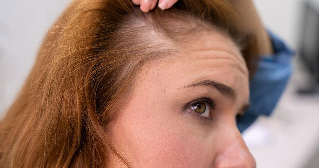 16 raisons à la perte de cheveux chez la femme: des experts révèlent quoi faire - Clinique à Deux Cheveux