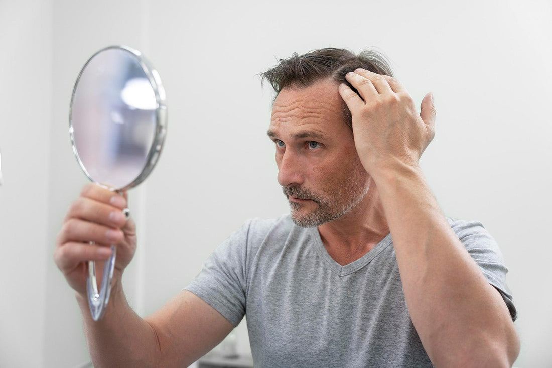 Calvitie masculine : la perte de cheveux chez l’homme expliquée - Clinique à Deux Cheveux
