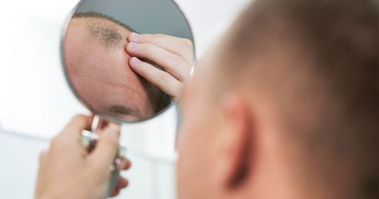 Comprendre la Perte de Cheveux chez l'Homme: 4 Phases que tu dois Connaître