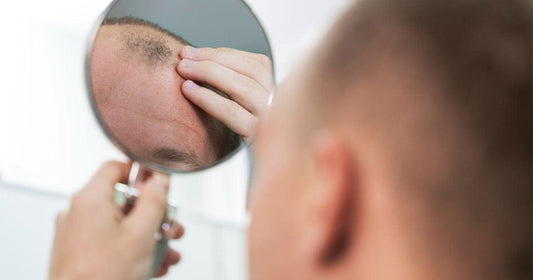 Comprendre la Perte de Cheveux chez l'Homme: 4 Phases que tu dois Connaître - Clinique à Deux Cheveux